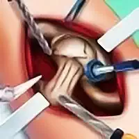 elsa_hip_surgery ហ្គេម