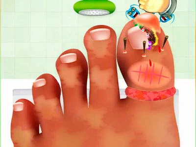 Juego De Cirugía De Uñas captura de pantalla del juego